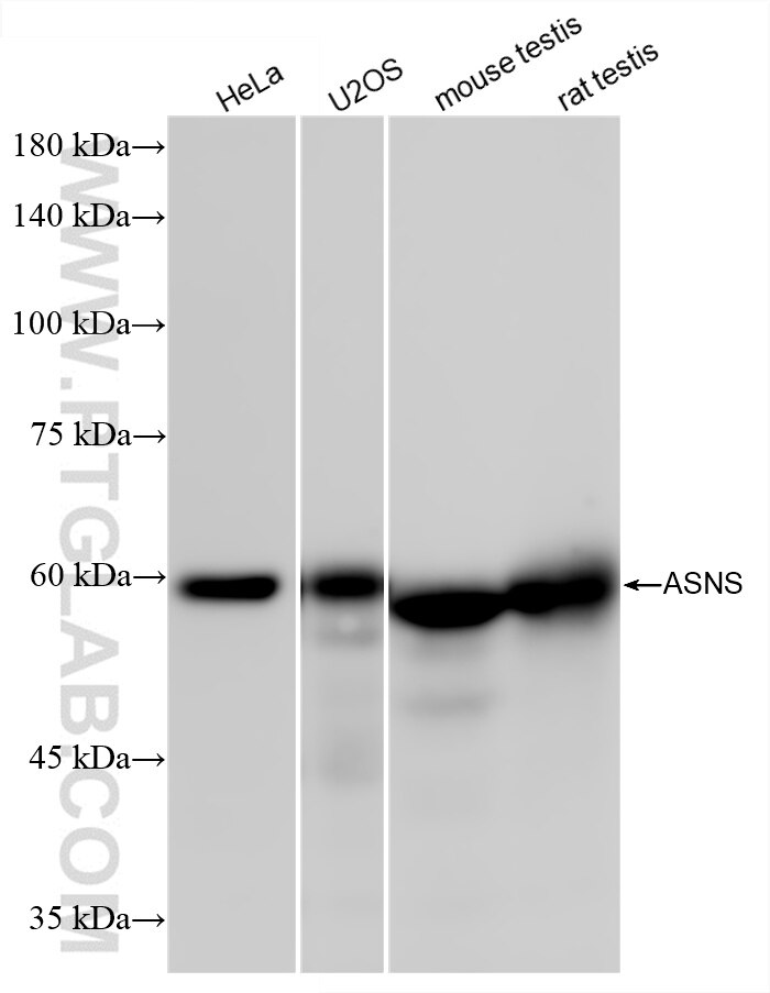 Western Blot (WB) analysis of various lysates using ASNS Recombinant antibody (85892-1-RR)