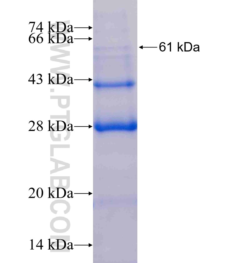 ASNS fusion protein Ag6393 SDS-PAGE