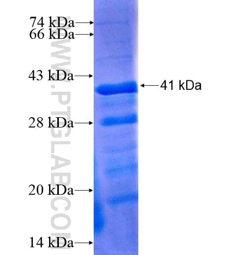 ASNS fusion protein Ag6817 SDS-PAGE