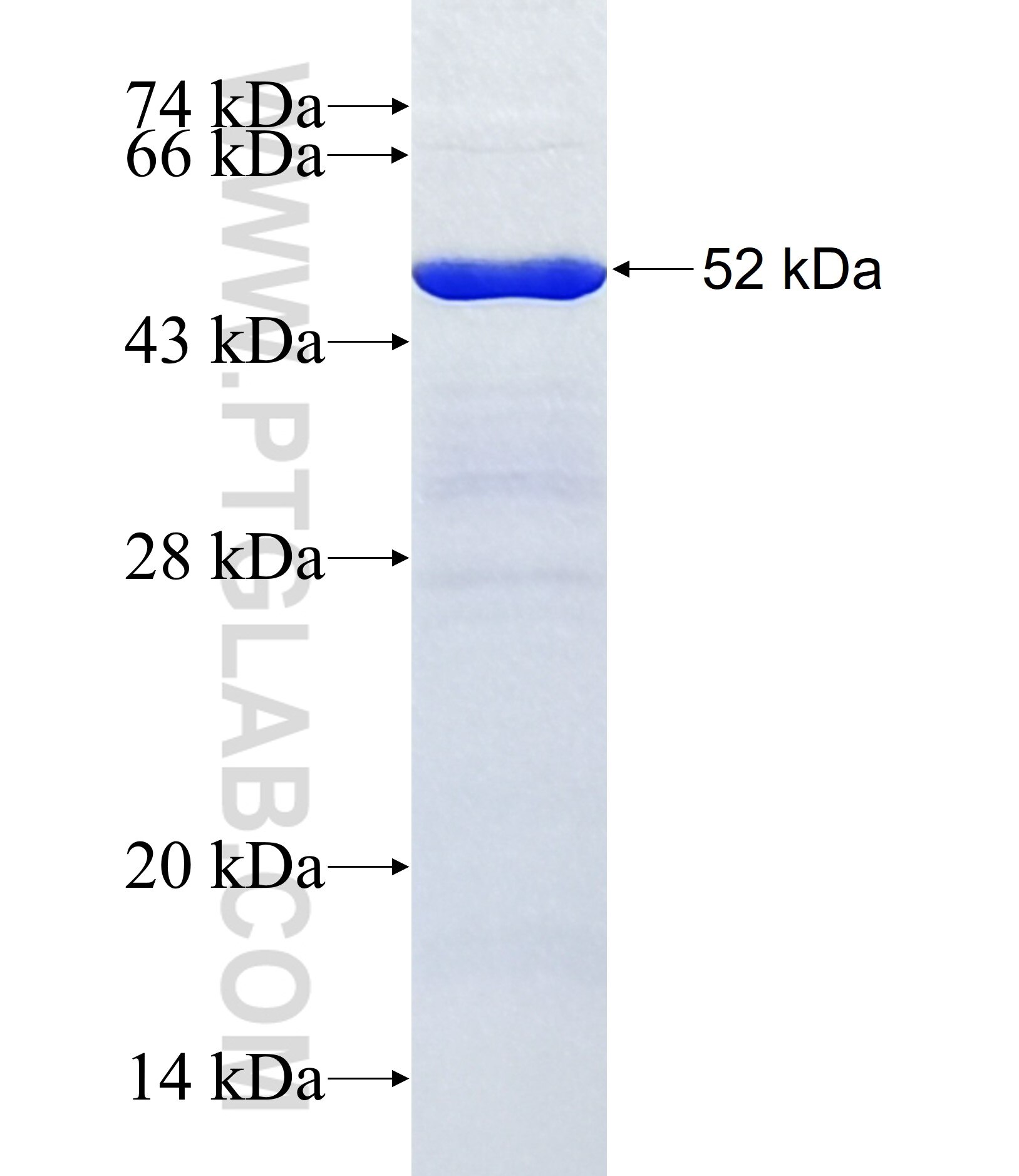 ASNSD1 fusion protein Ag37503 SDS-PAGE ASNSD1 fusion protein Ag37503 SDS-PAGE