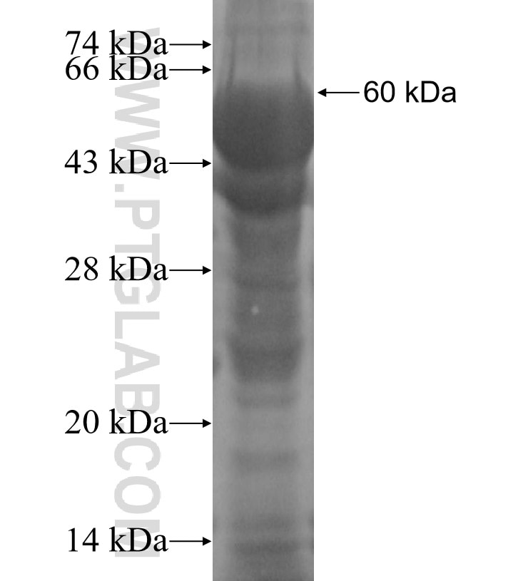 ASPA fusion protein Ag4029 SDS-PAGE