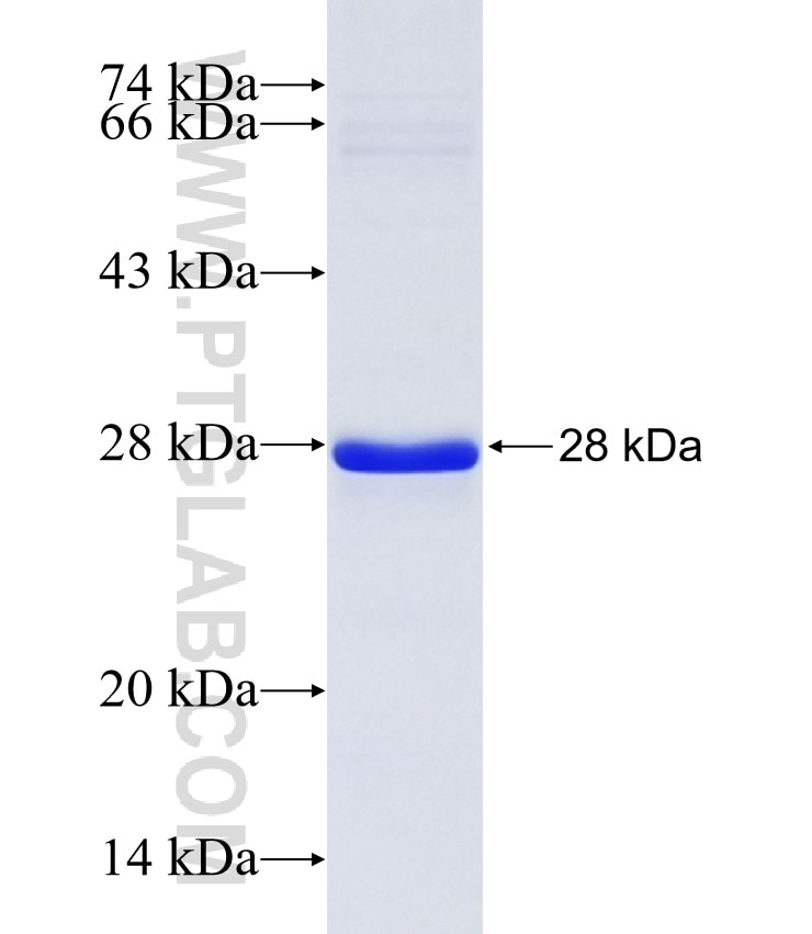 ASPG fusion protein Ag37309 SDS-PAGE ASPG fusion protein Ag37309 SDS-PAGE