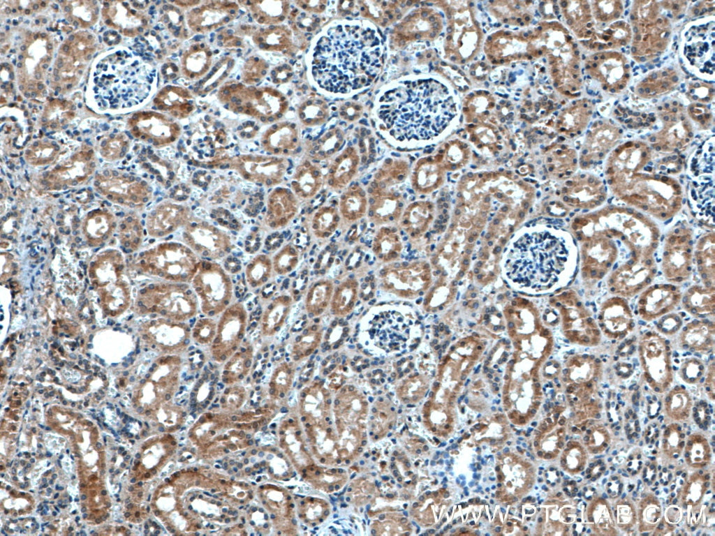 Immunohistochemistry (IHC) staining of human kidney tissue using ASPH Polyclonal antibody (14116-1-AP)