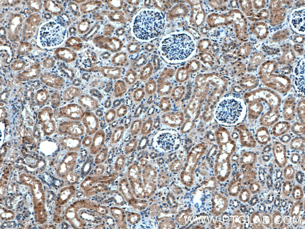 IHC staining of human kidney using 14116-1-AP