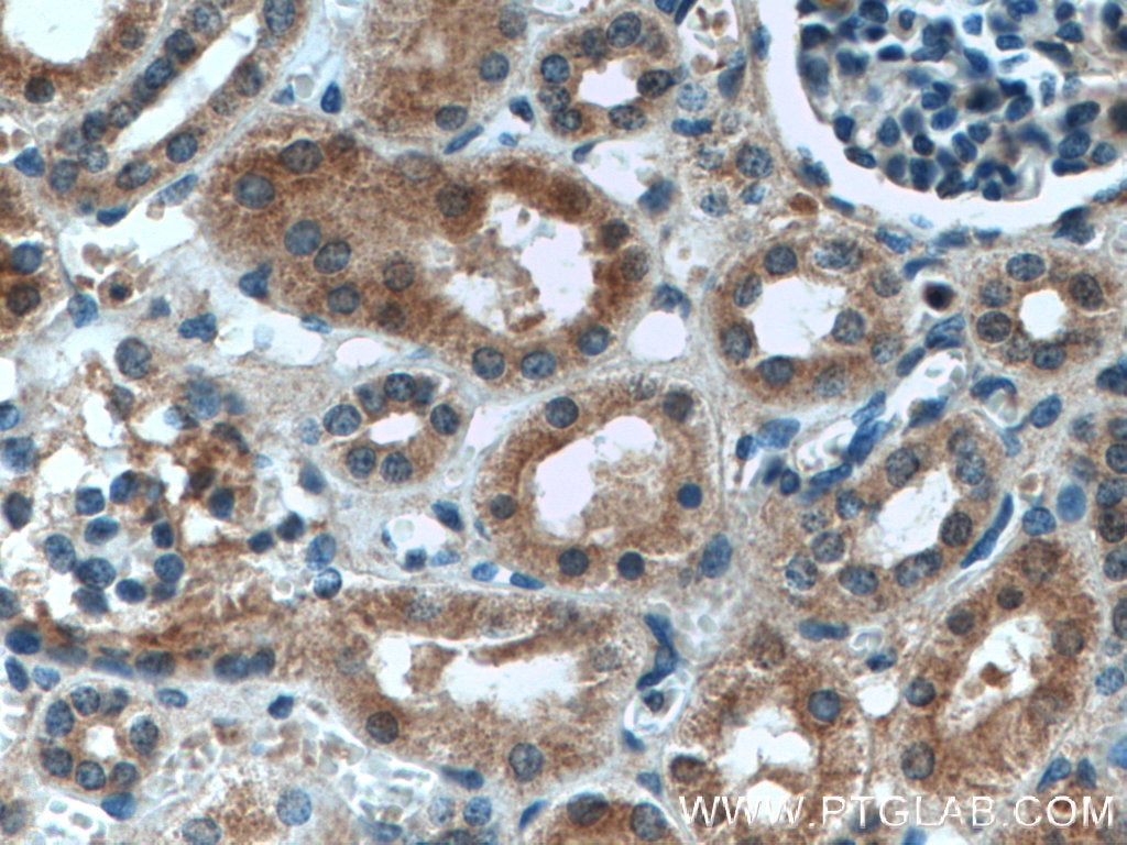 Immunohistochemistry (IHC) staining of human kidney tissue using ASPH Polyclonal antibody (14116-1-AP)