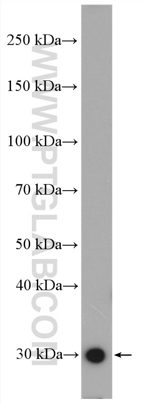 WB analysis of mouse brain using 14116-1-AP