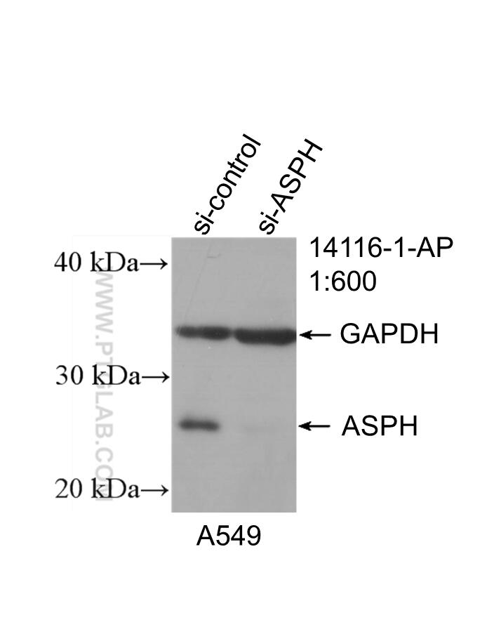 Western Blot (WB) analysis of A549 cells using ASPH Polyclonal antibody (14116-1-AP)