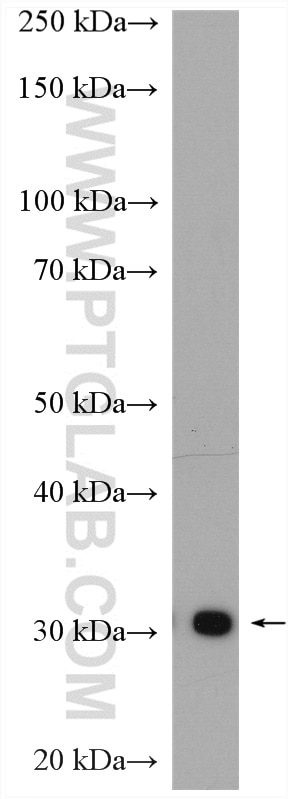 Western Blot (WB) analysis of mouse brain tissue using ASPH Polyclonal antibody (14116-1-AP)
