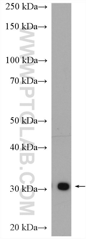 WB analysis of mouse brain using 14116-1-AP