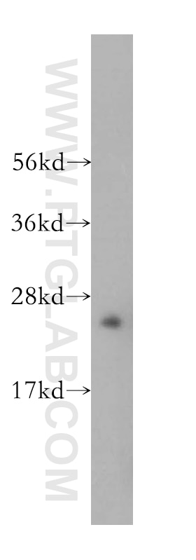 Western Blot (WB) analysis of human brain tissue using ASPH Polyclonal antibody (14116-1-AP)