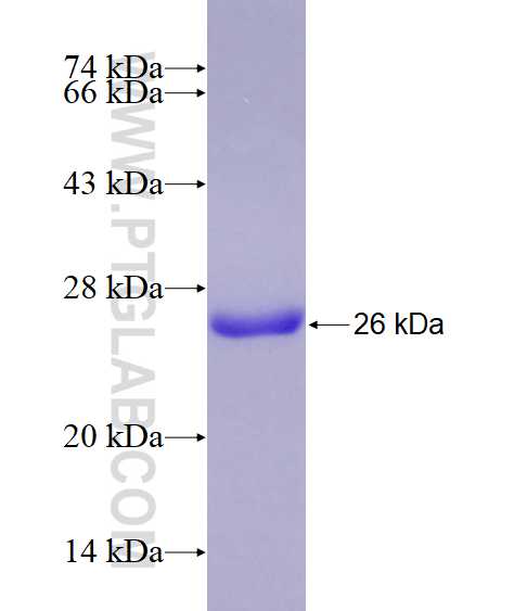 ASPH fusion protein Ag28428 SDS-PAGE