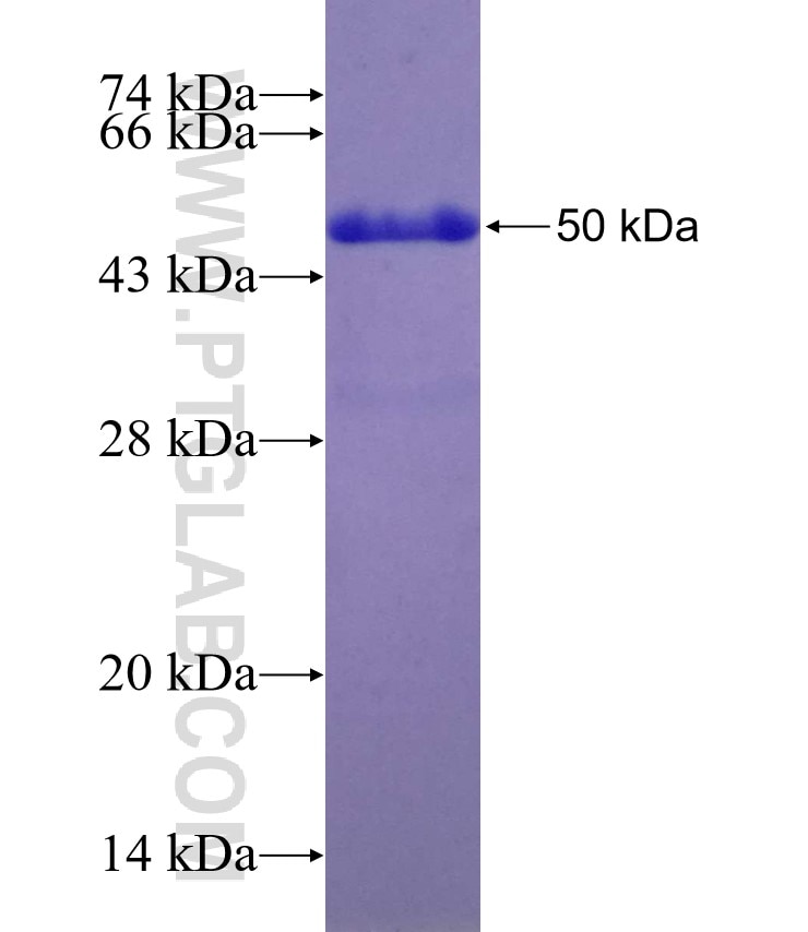 ASPH fusion protein Ag5265 SDS-PAGE