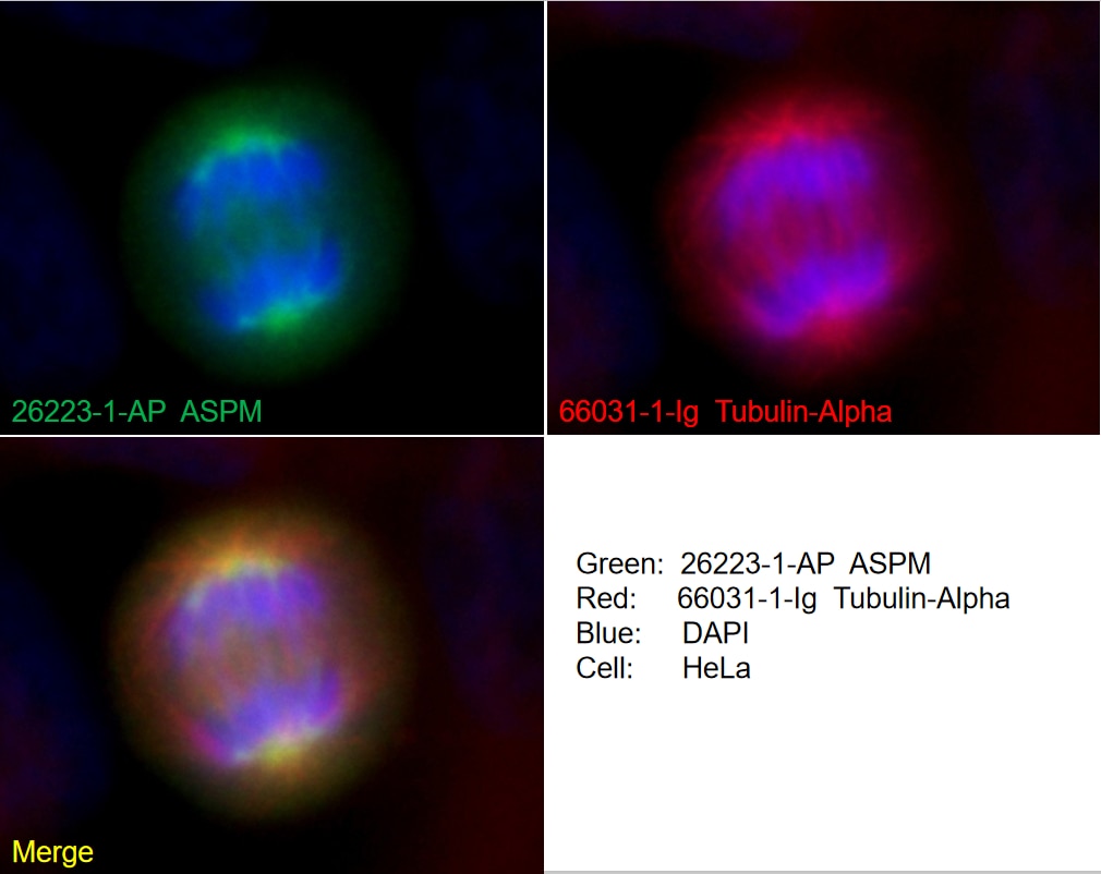 Immunofluorescence (IF) / fluorescent staining of HeLa cells using ASPM Polyclonal antibody (26223-1-AP)