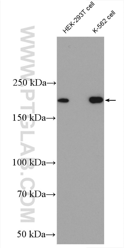 Western Blot (WB) analysis of various lysates using ASPM Polyclonal antibody (26223-1-AP)