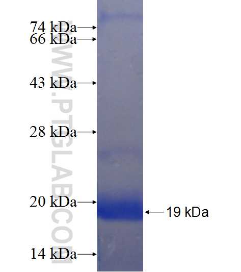 ASPM fusion protein Ag24166 SDS-PAGE