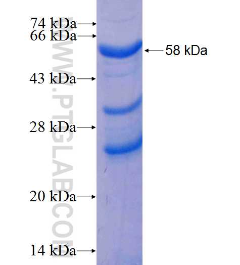 ASPN fusion protein Ag26380 SDS-PAGE