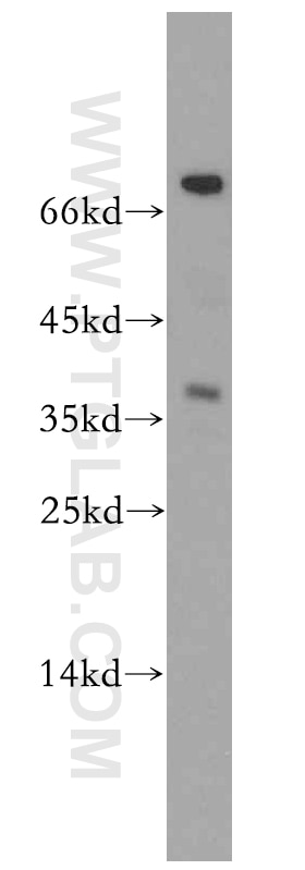 Western Blot (WB) analysis of mouse brain tissue using ASPRV1 Polyclonal antibody (13052-1-AP)