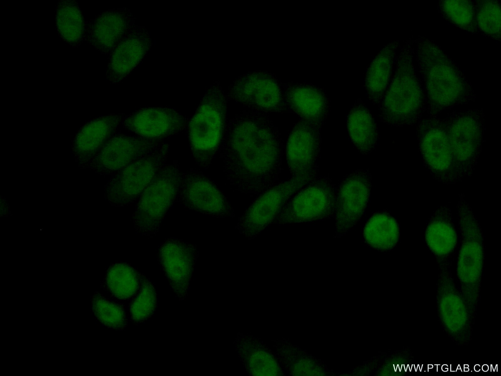 Immunofluorescence (IF) / fluorescent staining of HeLa cells using ASRGL1 Polyclonal antibody (11400-1-AP)