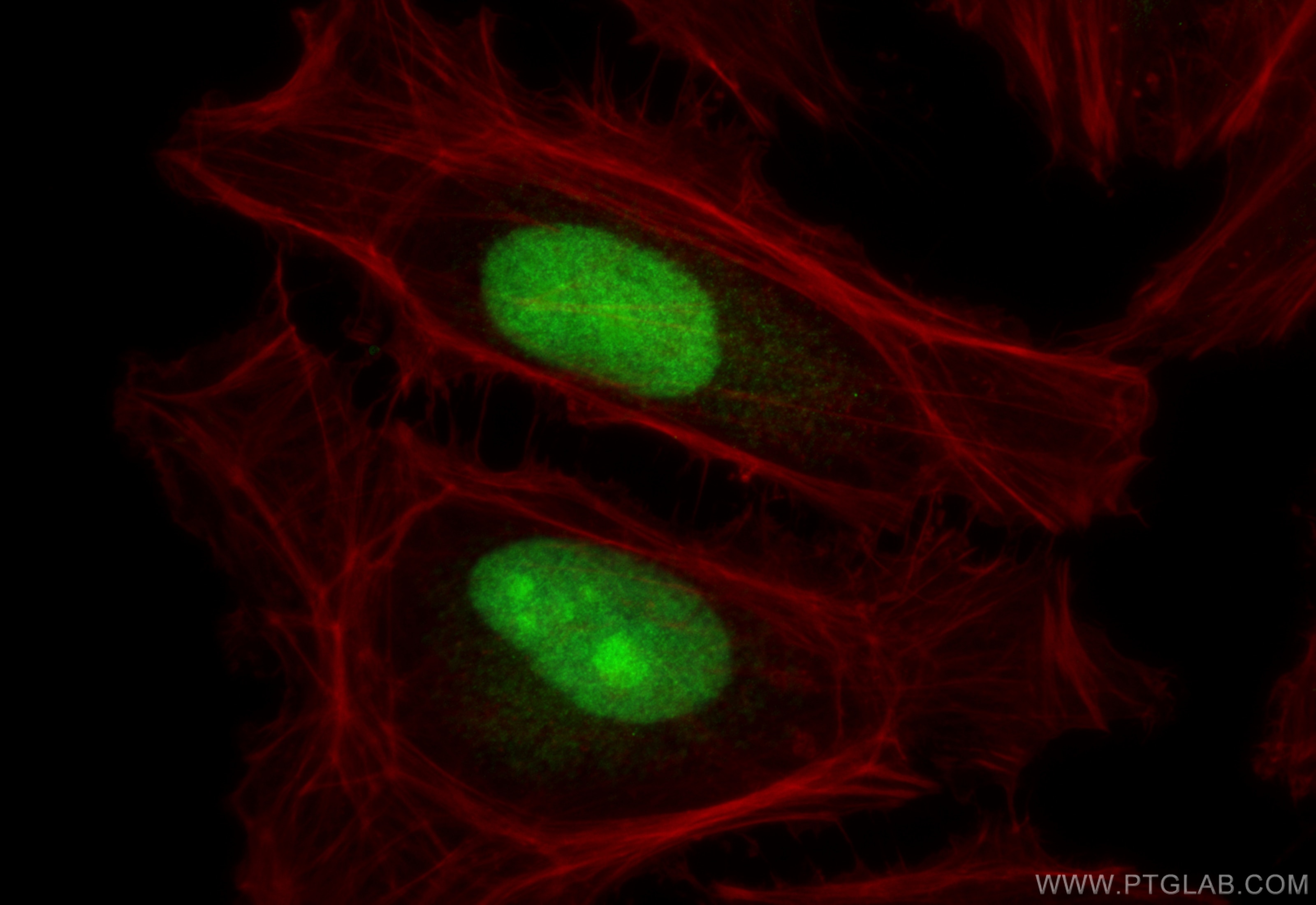Immunofluorescence (IF) / fluorescent staining of HeLa cells using ASRGL1 Polyclonal antibody (11400-1-AP)