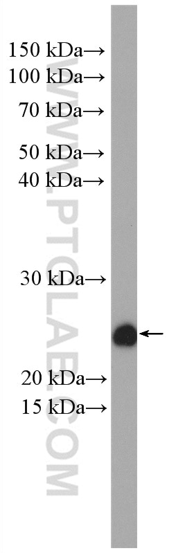 Western Blot (WB) analysis of mouse testis tissue using ASRGL1 Polyclonal antibody (11400-1-AP)