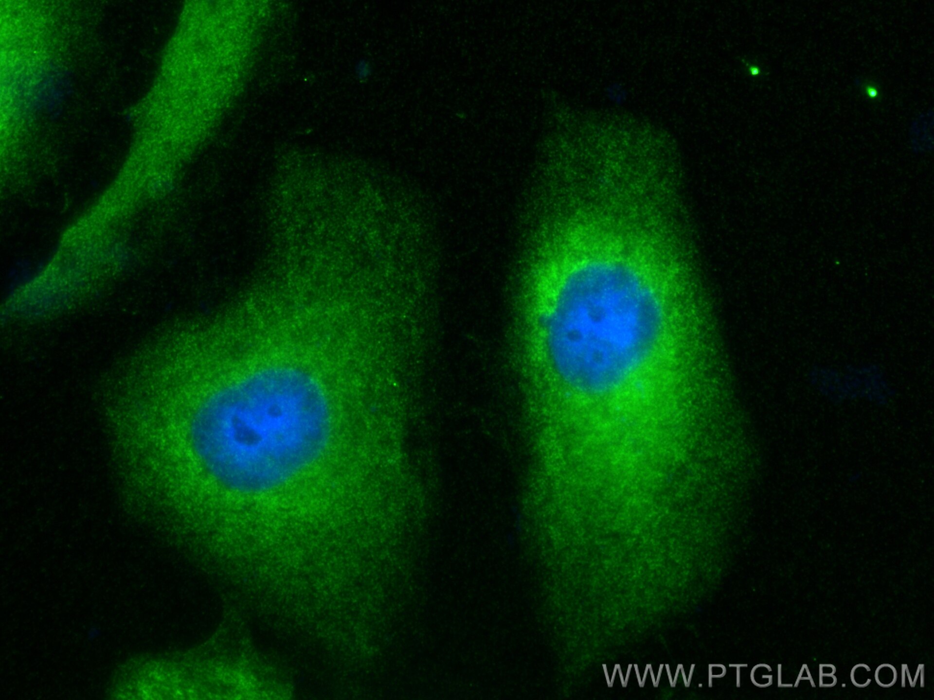Immunofluorescence (IF) / fluorescent staining of HeLa cells using ASS1 Polyclonal antibody (16210-1-AP)