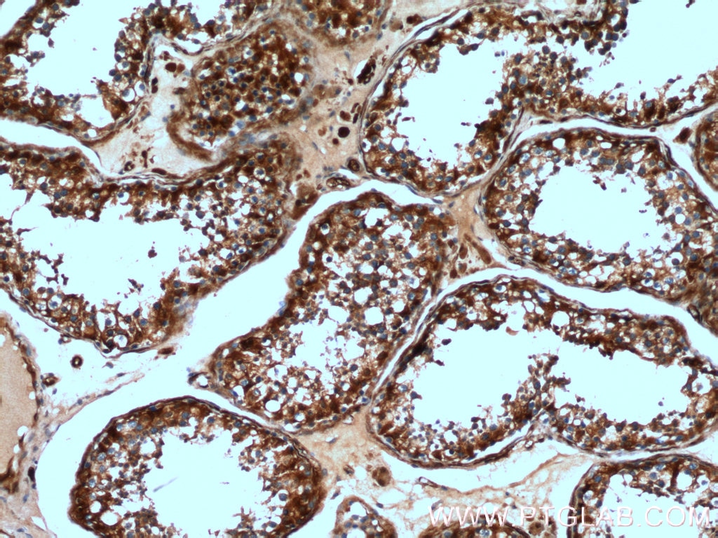 Immunohistochemistry (IHC) staining of human testis tissue using ASS1 Polyclonal antibody (16210-1-AP)