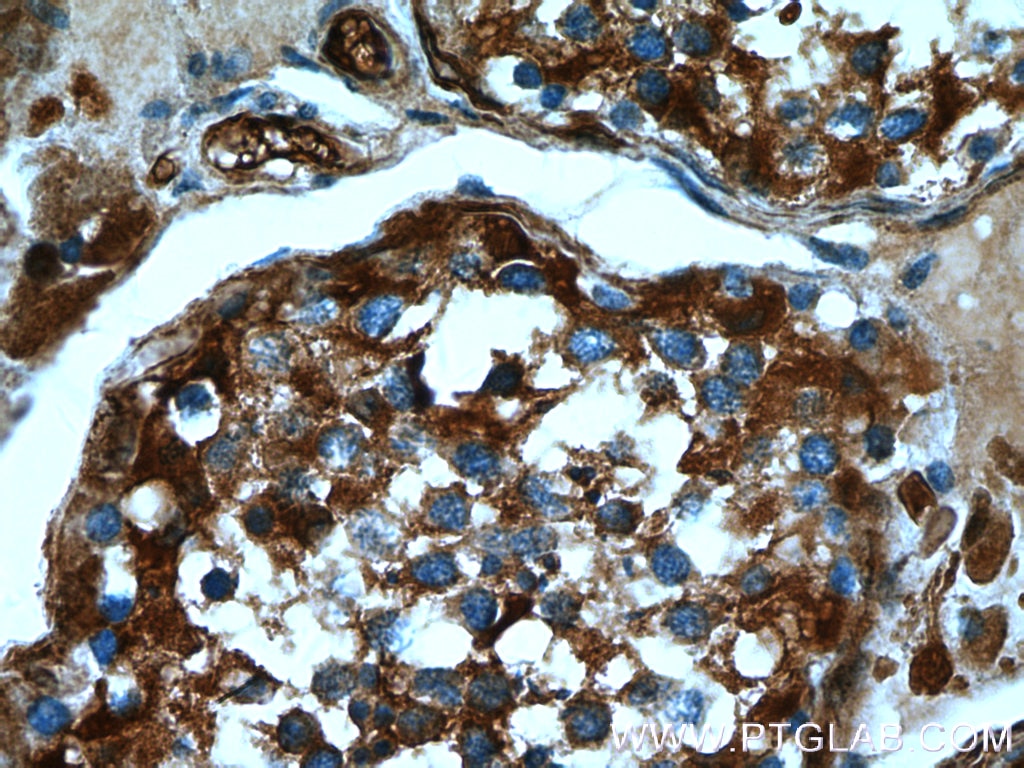 Immunohistochemistry (IHC) staining of human testis tissue using ASS1 Polyclonal antibody (16210-1-AP)