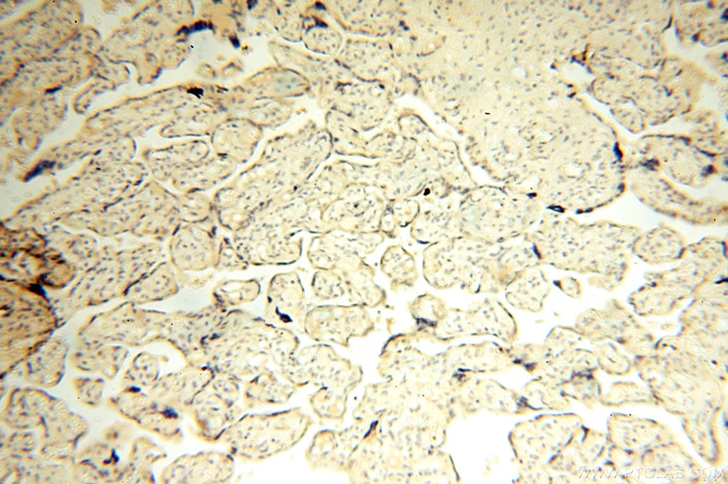 Immunohistochemistry (IHC) staining of human placenta tissue using ASS1 Polyclonal antibody (16210-1-AP)