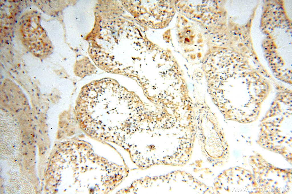 Immunohistochemistry (IHC) staining of human testis tissue using ASS1 Polyclonal antibody (16210-1-AP)