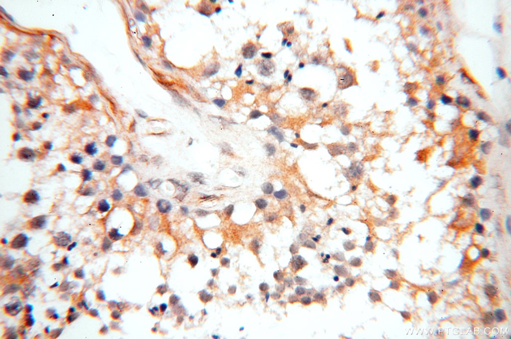 IHC staining of human testis using 16210-1-AP