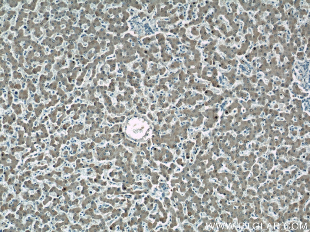Immunohistochemistry (IHC) staining of human liver tissue using ASS1 Polyclonal antibody (16210-1-AP)