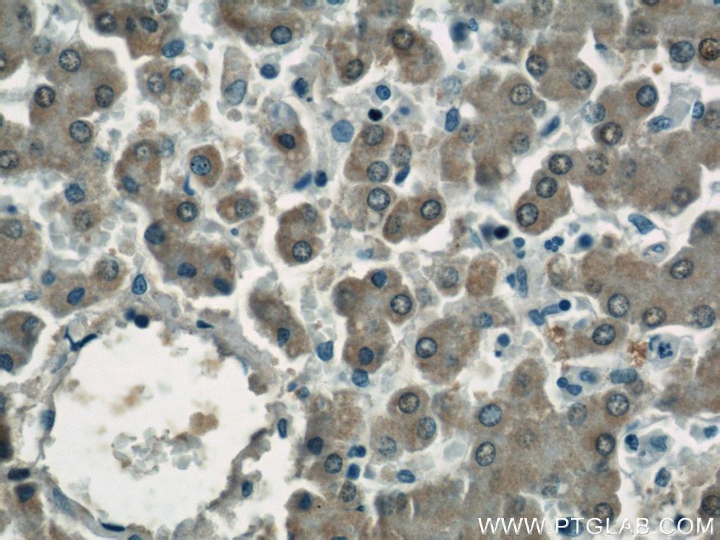 IHC staining of human liver using 16210-1-AP