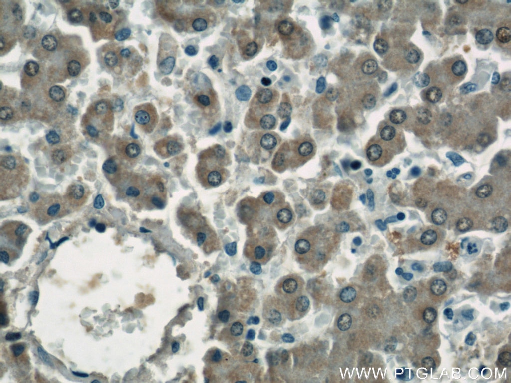 Immunohistochemistry (IHC) staining of human liver tissue using ASS1 Polyclonal antibody (16210-1-AP)