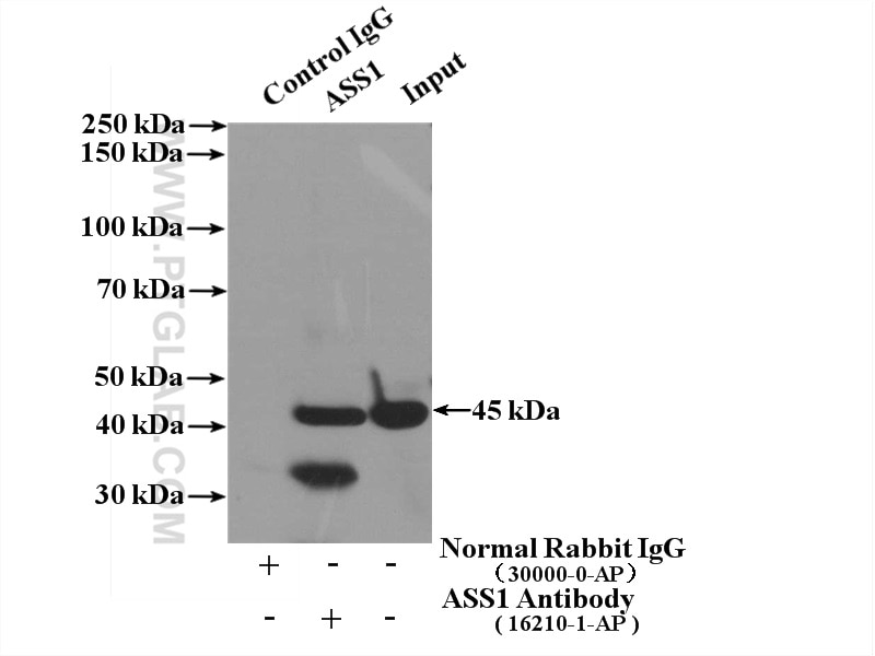 Immunoprecipitation (IP) experiment of HeLa cells using ASS1 Polyclonal antibody (16210-1-AP)