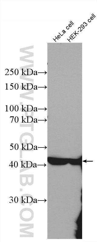 Western Blot (WB) analysis of various lysates using ASS1 Polyclonal antibody (16210-1-AP)