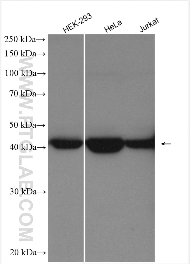 Western Blot (WB) analysis of various lysates using ASS1 Polyclonal antibody (16210-1-AP)