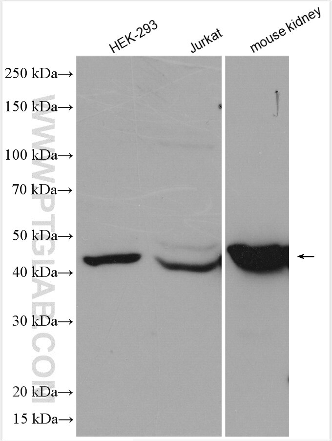 Western Blot (WB) analysis of various lysates using ASS1 Polyclonal antibody (16210-1-AP)