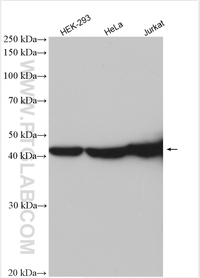 Western Blot (WB) analysis of various lysates using ASS1 Polyclonal antibody (16210-1-AP)