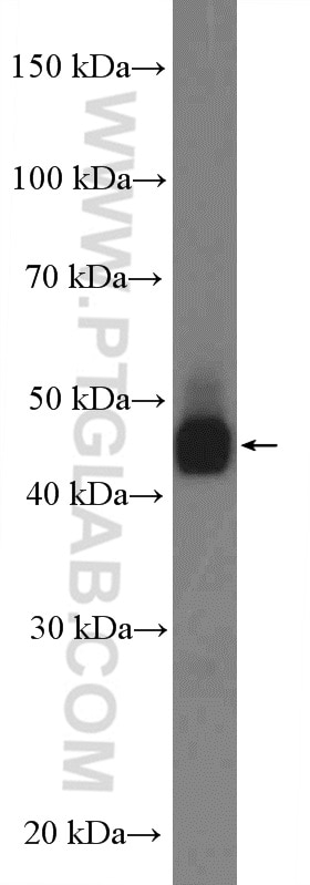 Western Blot (WB) analysis of SMMC-7721 cells using ASS1 Polyclonal antibody (16210-1-AP)