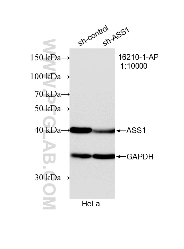 Western Blot (WB) analysis of HeLa cells using ASS1 Polyclonal antibody (16210-1-AP)
