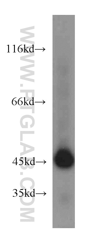 Western Blot (WB) analysis of rat kidney tissue using ASS1 Polyclonal antibody (16210-1-AP)