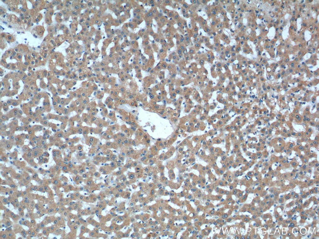 IHC staining of human liver using 66036-1-Ig
