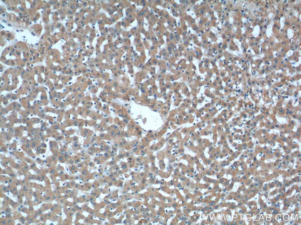 Immunohistochemistry (IHC) staining of human liver tissue using ASS1 Monoclonal antibody (66036-1-Ig)