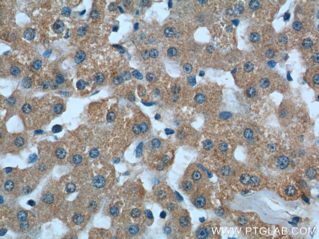 Immunohistochemistry (IHC) staining of human liver tissue using ASS1 Monoclonal antibody (66036-1-Ig)