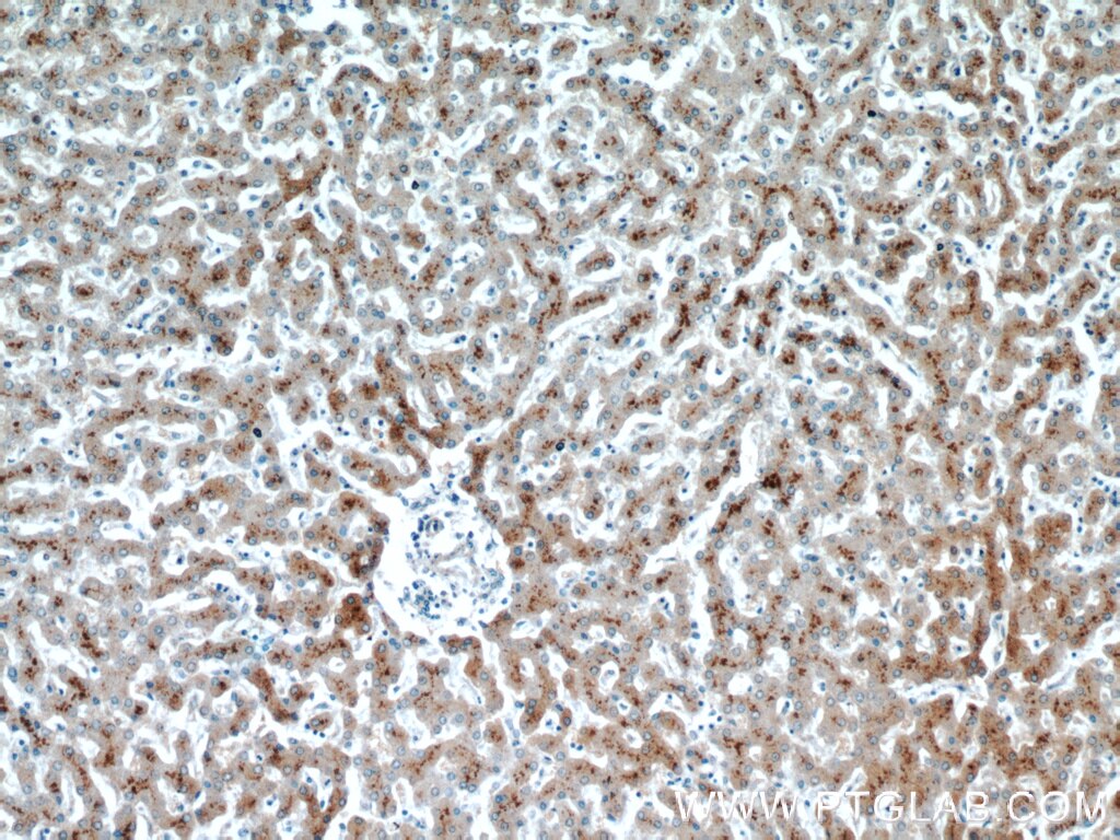 Immunohistochemistry (IHC) staining of human liver tissue using ASS1 Monoclonal antibody (66036-1-Ig)