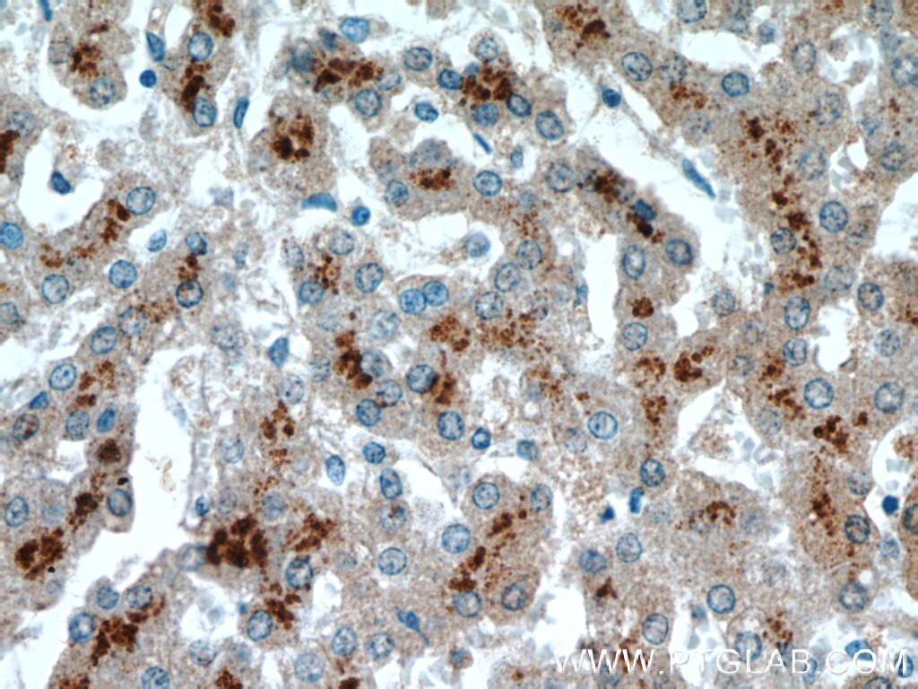 Immunohistochemistry (IHC) staining of human liver tissue using ASS1 Monoclonal antibody (66036-1-Ig)