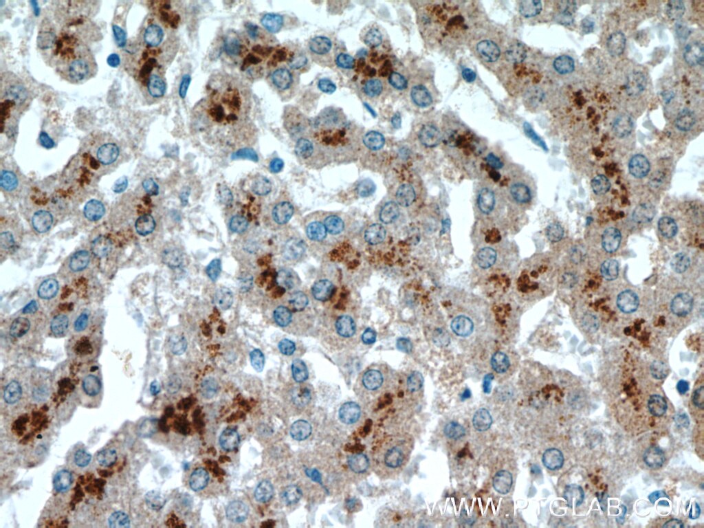 IHC staining of human liver using 66036-1-Ig