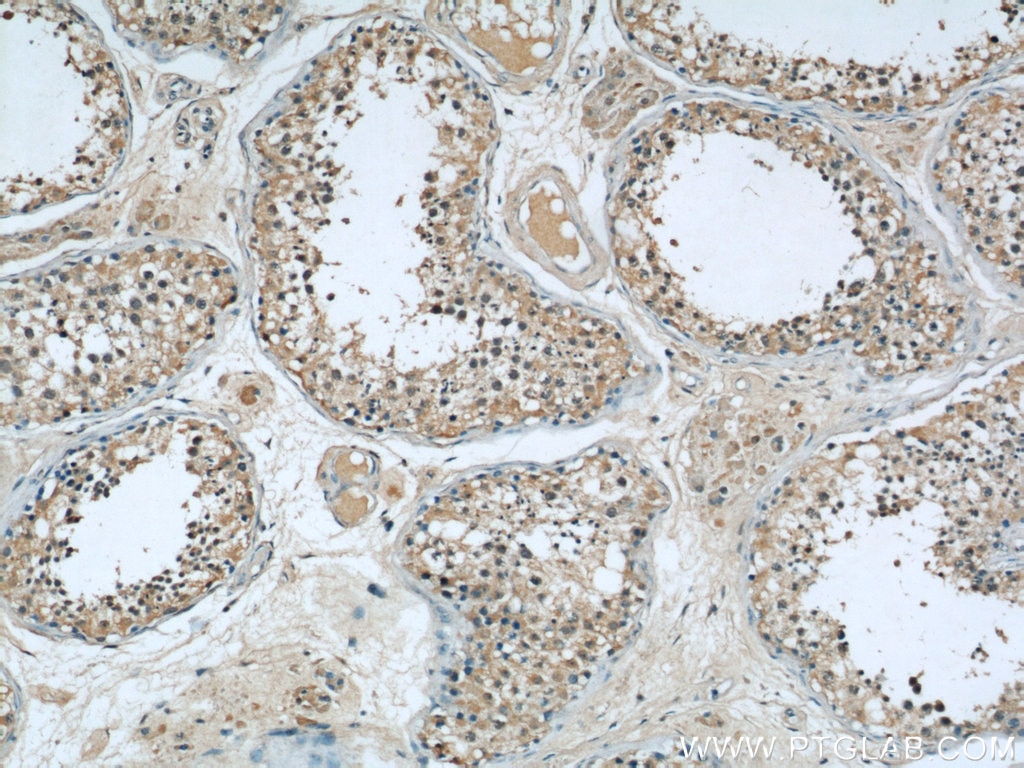 Immunohistochemistry (IHC) staining of human testis tissue using ASS1 Monoclonal antibody (66036-1-Ig)