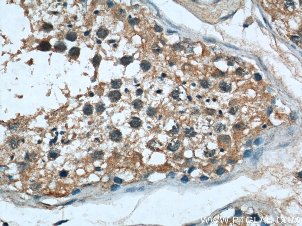 IHC staining of human testis using 66036-1-Ig