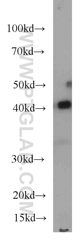 Western Blot (WB) analysis of HeLa cells using ASS1 Monoclonal antibody (66036-1-Ig)